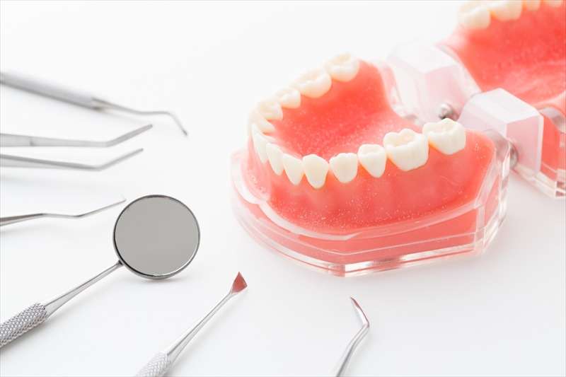 矯正歯科治療の種類・料金
